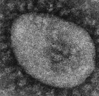 coronavirus